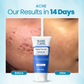 RARE CARE Daily Facial Cleanser - Brightens & Moisturizes Skin - 100% Natural Product - FDA-approved