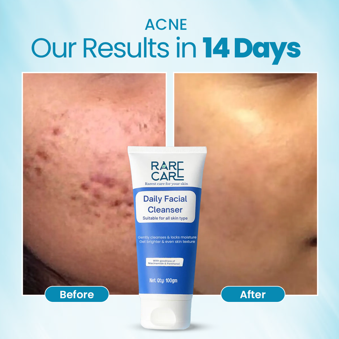RARE CARE Daily Facial Cleanser - Brightens & Moisturizes Skin - 100% Natural Product - FDA-approved