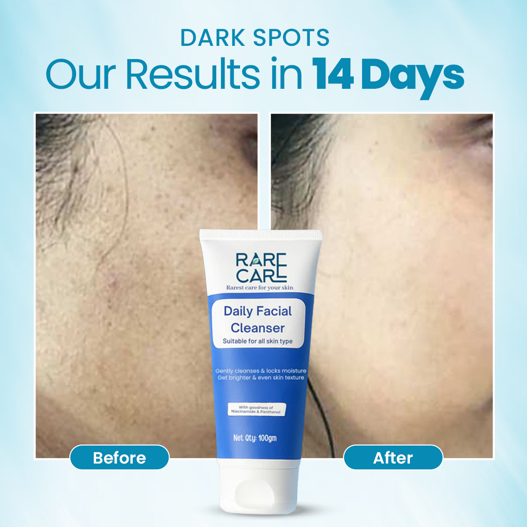 RARE CARE Daily Facial Cleanser - Brightens & Moisturizes Skin - 100% Natural Product - FDA-approved