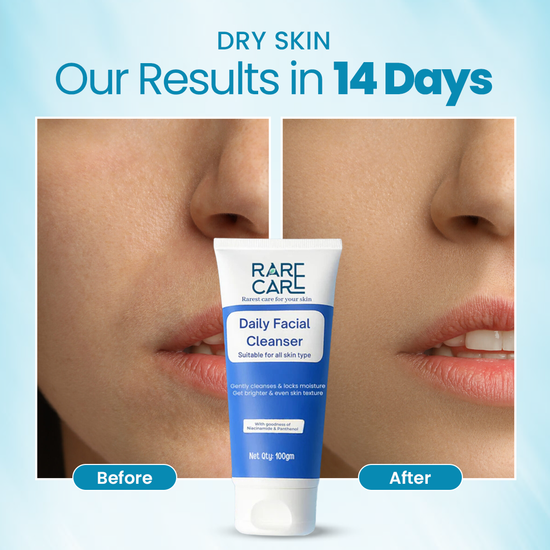 RARE CARE Daily Facial Cleanser - Brightens & Moisturizes Skin - 100% Natural Product - FDA-approved