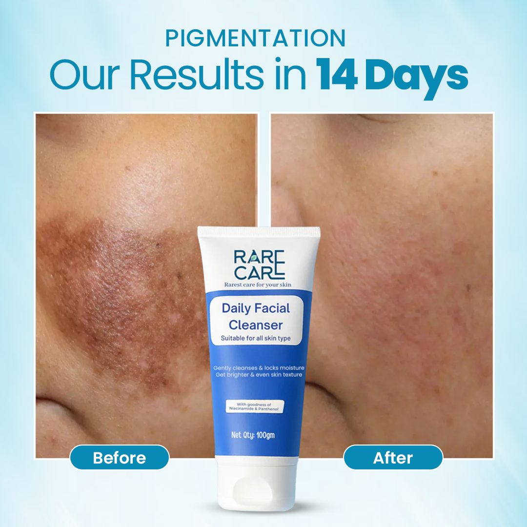 RARE CARE Daily Facial Cleanser - Brightens & Moisturizes Skin - 100% Natural Product - FDA-approved
